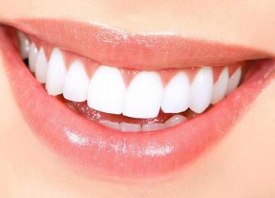 بریج دندان چیست و چگونه انجام می گردد؟