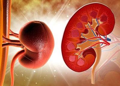 روش های درمانی طبیعی برای دفع سنگ کلیه